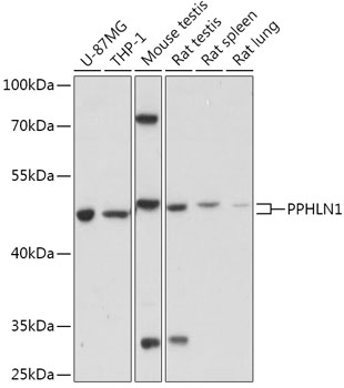 Western blot analysis of extracts of various cell lines using PPHLN1 Polyclonal Antibody at 1:1000 dilution.