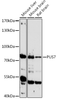 Western blot analysis of extracts of various cell lines using PUS7 Polyclonal Antibody at 1:1000 dilution.