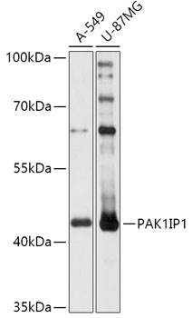 Western blot analysis of extracts of various cell lines using PAK1IP1 Polyclonal Antibody at 1:1000 dilution.