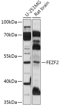 Western blot analysis of extracts of various cell lines using FEZF2 Polyclonal Antibody at 1:1000 dilution.