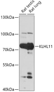 Western blot analysis of extracts of various cell lines using KLHL11 Polyclonal Antibody at 1:1000 dilution.