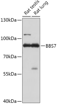 Western blot analysis of extracts of various cell lines using BBS7 Polyclonal Antibody at 1:1000 dilution.