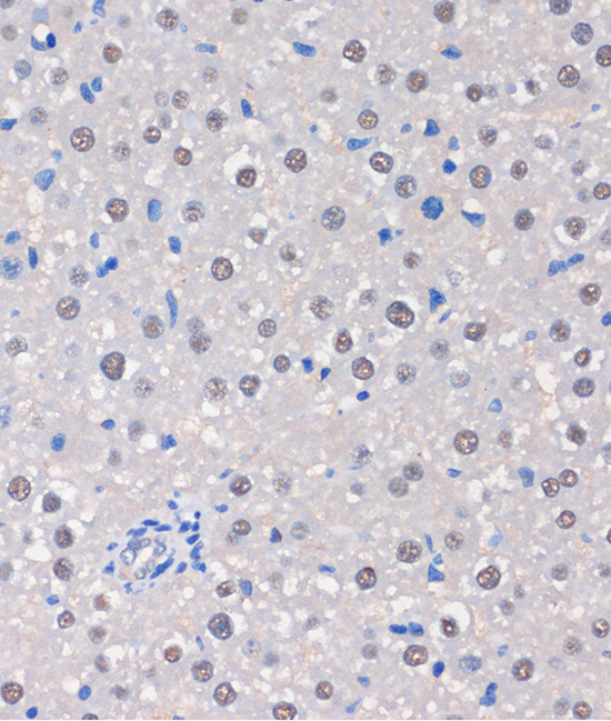 Immunohistochemistry of paraffin-embedded Rat liver using MTMR8 Polyclonal Antibody at dilution of 1:100 (40x lens).Perform microwave antigen retrieval with 10 mM PBS buffer pH 7.2 before commencing with IHC staining protocol.