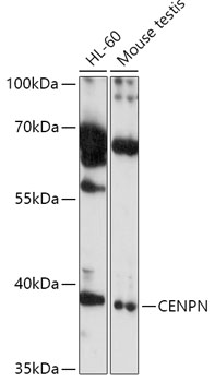 Western blot analysis of extracts of various cell lines using CENPN Polyclonal Antibody at 1:1000 dilution.