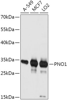 Western blot analysis of extracts of various cell lines using PNO1 Polyclonal Antibody at 1:1000 dilution.