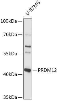 Western blot analysis of extracts of U-87MG cells using PRDM12 Polyclonal Antibody at 1:1000 dilution.