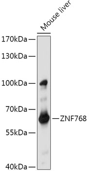 Western blot analysis of extracts of Mouse liver using ZNF768 Polyclonal Antibody at 1:1000 dilution.