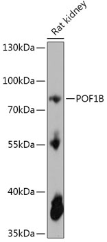 Western blot analysis of extracts of Rat kidney using POF1B Polyclonal Antibody at 1:1000 dilution.