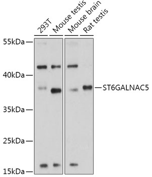 Western blot analysis of extracts of various cell lines using ST6GALNAC5 Polyclonal Antibody at 1:1000 dilution.