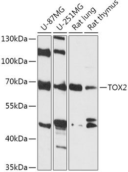 Western blot analysis of extracts of various cell lines using TOX2 Polyclonal Antibody at 1:1000 dilution.