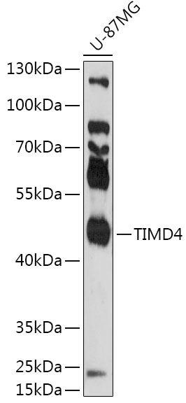 Western blot analysis of extracts of U-87MG cells using TIMD4 Polyclonal Antibody at 1:1000 dilution.