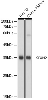 Western blot analysis of extracts of various cell lines using SFXN2 Polyclonal Antibody at 1:1000 dilution.