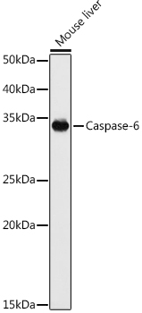 Western blot analysis of extracts of various cell lines using Caspase-6 Polyclonal Antibody at 1:1000 dilution.