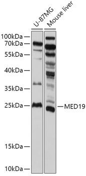 Western blot analysis of extracts of various cell lines using MED19 Polyclonal Antibody at 1:1000 dilution.