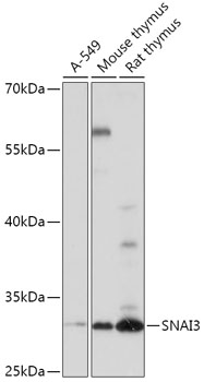 Western blot analysis of extracts of various cell lines using SNAI3 Polyclonal Antibody at 1:1000 dilution.