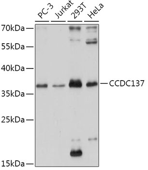 Western blot analysis of extracts of various cell lines using CCDC137 Polyclonal Antibody at 1:1000 dilution.