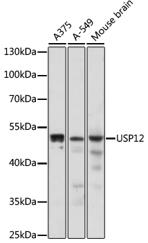 Western blot analysis of extracts of various cell lines using USP12 Polyclonal Antibody at 1:1000 dilution.