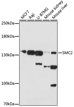 Western blot analysis of extracts of various cells using SMC2 Polyclonal Antibody at 1:1000 dilution.