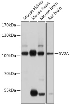 Western blot analysis of extracts of various cell lines using SV2A Polyclonal Antibody at 1:1000 dilution.