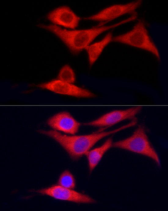 Immunofluorescence analysis of PC-12 cells using CYP7B1 Polyclonal Antibody at dilution of 1:20 (40x lens). Blue: DAPI for nuclear staining.