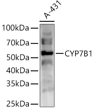 Western blot analysis of A-431 using CYP7B1 Polyclonal Antibody at 1:2000 dilution.