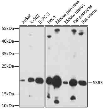 Western blot analysis of extracts of various cells using SSR3 Polyclonal Antibody at 1:1000 dilution.