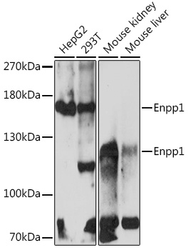 Western blot analysis of extracts of various cell lines using Enpp1 Polyclonal Antibody at1:1000 dilution.