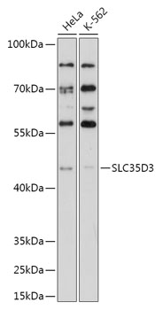 Western blot analysis of extracts of various cell lines using SLC35D3 Polyclonal Antibody at 1:1000 dilution.