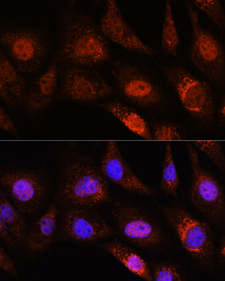 Immunofluorescence analysis of NIH/3T3 cells using ZC3H12D Polyclonal Antibody at dilution of 1:100. Blue: DAPI for nuclear staining.