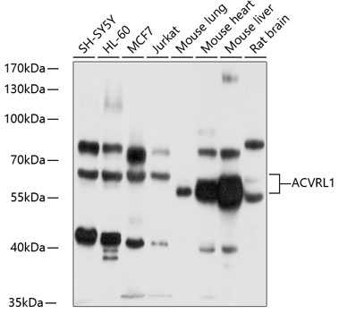 Western blot analysis of extracts of various cell lines using ACVRL1 Polyclonal Antibody at 1:1000 dilution.