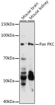 Western blot analysis of extracts of various cell lines using Pan PKC Polyclonal Antibody at 1:500 dilution.