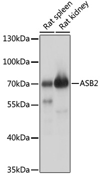 Western blot analysis of extracts of various cell lines using ASB2 Polyclonal Antibody at 1:1000 dilution.