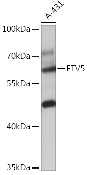 Western blot analysis of extracts of A-431 cells using ETV5 Polyclonal Antibody at 1:1000 dilution.