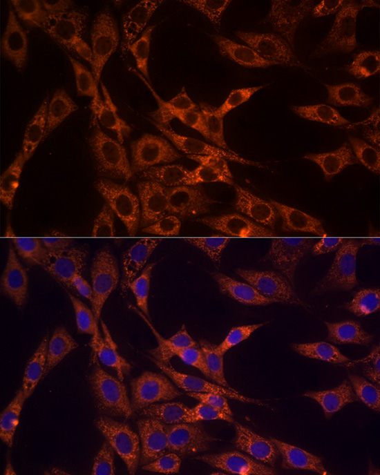 Immunofluorescence analysis of NIH/3T3 cells using PDCD1LG2 Polyclonal Antibody at dilution of 1:50 (40x lens). Blue: DAPI for nuclear staining.