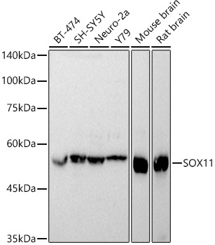 Western blot analysis of extracts of various cell lines using SOX11  Polyclonal Antibody at 1:1000 dilution.
