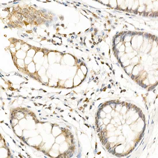 Immunohistochemistry of paraffin-embedded human colon using RGS2 Polyclonal Antibody at dilution of 1:100 (40x lens).Perform high pressure antigen retrieval with 10 mM citrate buffer pH 6.0 before commencing with IHC staining protocol.