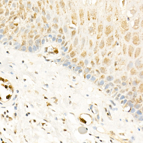 Immunohistochemistry of paraffin-embedded human esophagus using RGS2 Polyclonal Antibody at dilution of 1:100 (40x lens).Perform high pressure antigen retrieval with 10 mM citrate buffer pH 6.0 before commencing with IHC staining protocol.