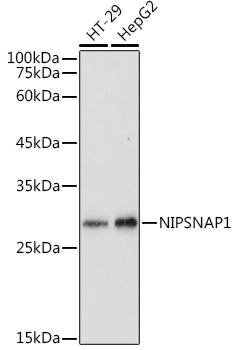 Western blot analysis of extracts of various cell lines using NIPSNAP1 Polyclonal Antibody at 1:1000 dilution.