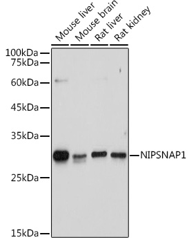 Western blot analysis of extracts of various cell lines using NIPSNAP1 Polyclonal Antibody at 1:1000 dilution.