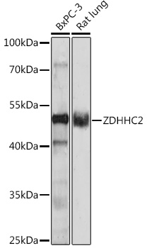 Western blot analysis of extracts of various cell lines using ZDHHC2 Polyclonal Antibody at 1:1000 dilution.