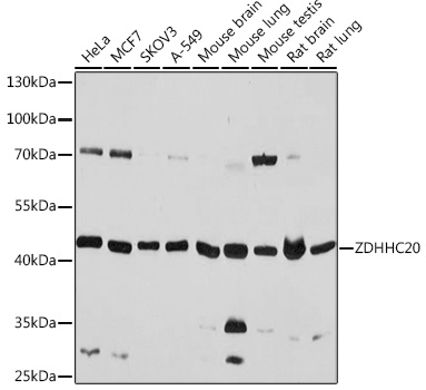 Western blot analysis of extracts of various cell lines using ZDHHC20 Polyclonal Antibody at 1:1000 dilution.