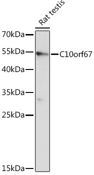 Western blot analysis of extracts of Rat testis using C10orf67 Polyclonal Antibody at 1:1000 dilution.