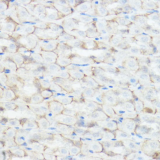 Immunohistochemistry of paraffin-embedded mouse stomach using GABRA2 Polyclonal Antibody at dilution of 1:200 (40x lens).Perform high pressure antigen retrieval with 10 mM citrate buffer pH 6.0 before commencing with IHC staining protocol.