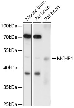 Western blot analysis of extracts of various cell lines using MCHR1 Polyclonal Antibody at 1:1000 dilution.