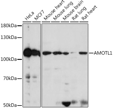 Western blot analysis of extracts of various cell lines using AMOTL1 Polyclonal Antibody at 1:1000 dilution.