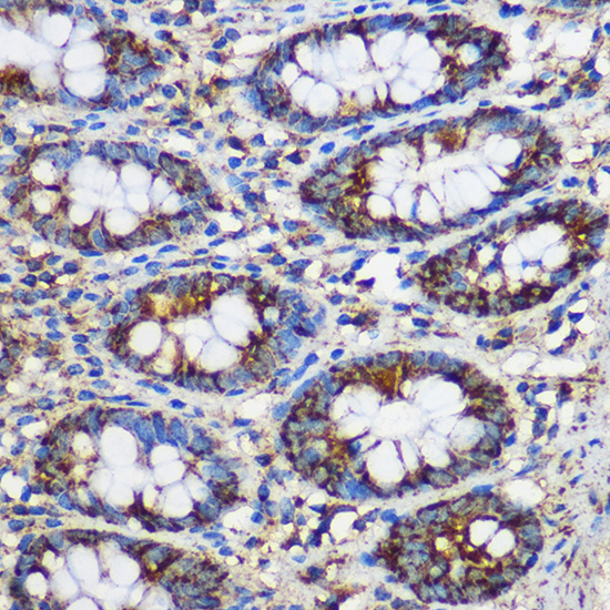 Immunohistochemistry of paraffin-embedded Human colon using TEX101 Polyclonal Antibody at dilution of 1:100 (40x lens).Perform microwave antigen retrieval with 10 mM PBS buffer pH 7.2 before commencing with IHC staining protocol.