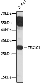 Western blot analysis of extracts of A-549 cells using TEX101 Polyclonal Antibody at1:1000 dilution.