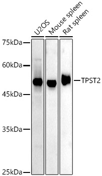 Western blot analysis of extracts of various cell lines using TPST2 Polyclonal Antibody at 1:500 dilution.