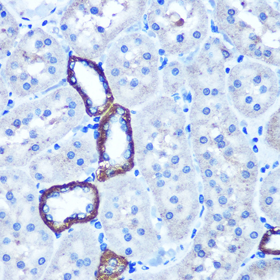 Immunohistochemistry of paraffin-embedded Rat kidney using TBCCD1 Polyclonal Antibody at dilution of 1:100 (40x lens).Perform microwave antigen retrieval with 10 mM PBS buffer pH 7.2 before commencing with IHC staining protocol.