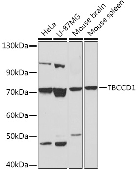 Western blot analysis of extracts of various cell lines using TBCCD1 Polyclonal Antibody at1:1000 dilution.